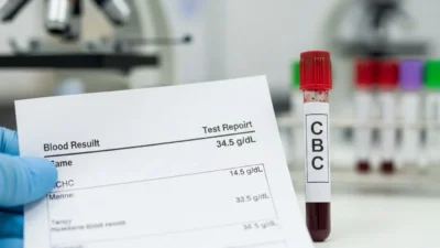 What Does MCHC Mean in a Blood Test